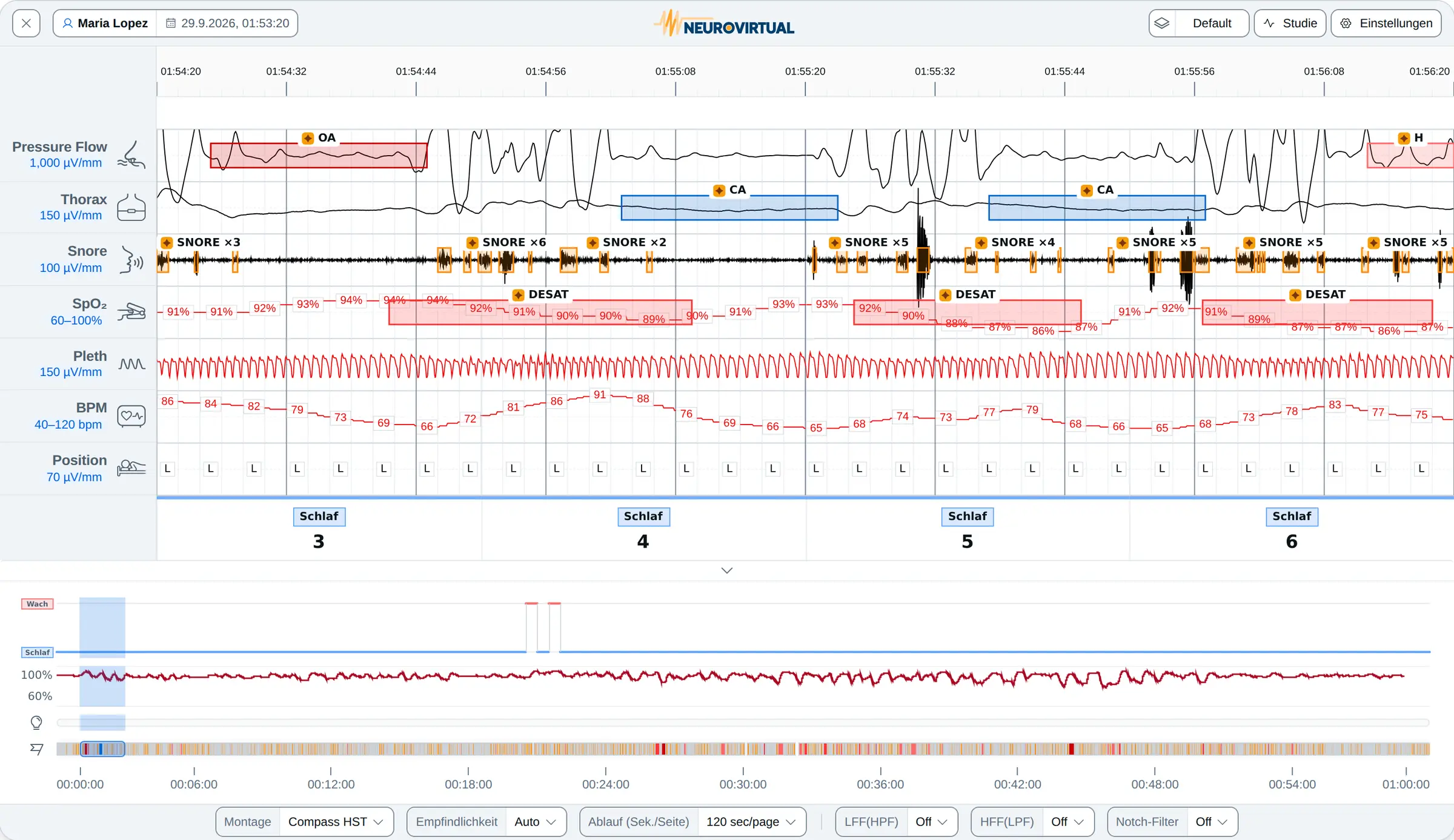 Zwei Minuten einer HST-Compass-Aufzeichnung in der Wellenansicht: Druckfluss, thorakale Atemanstrengung, Schnarchen, SpO₂, Plethysmogramm, Pulsfrequenz und Körperlage, mit ausgewerteten Ereignissen, Hypnogramm und dem SpO₂-Verlauf der ganzen Nacht